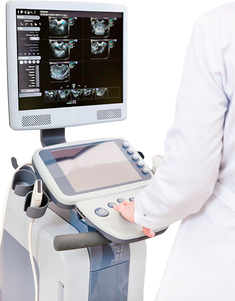УЗ Диагностика
